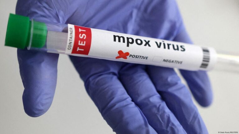 La viruela del mono se extiende en el Congo reporta The New York Times