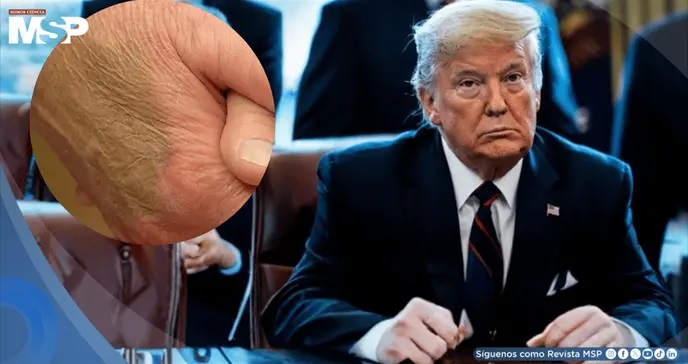 ¡Preocupante estado de salud de Donald Trump!