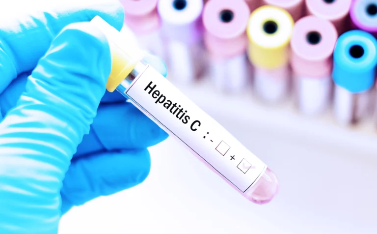 Hepatitis C ya es curable, y en México el tratamiento es gratuito