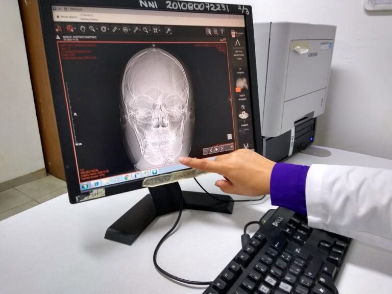 Beneficencia Pública de Tabasco gestiona costosa cirugía de reconstrucción mandibular para paciente de Macuspana